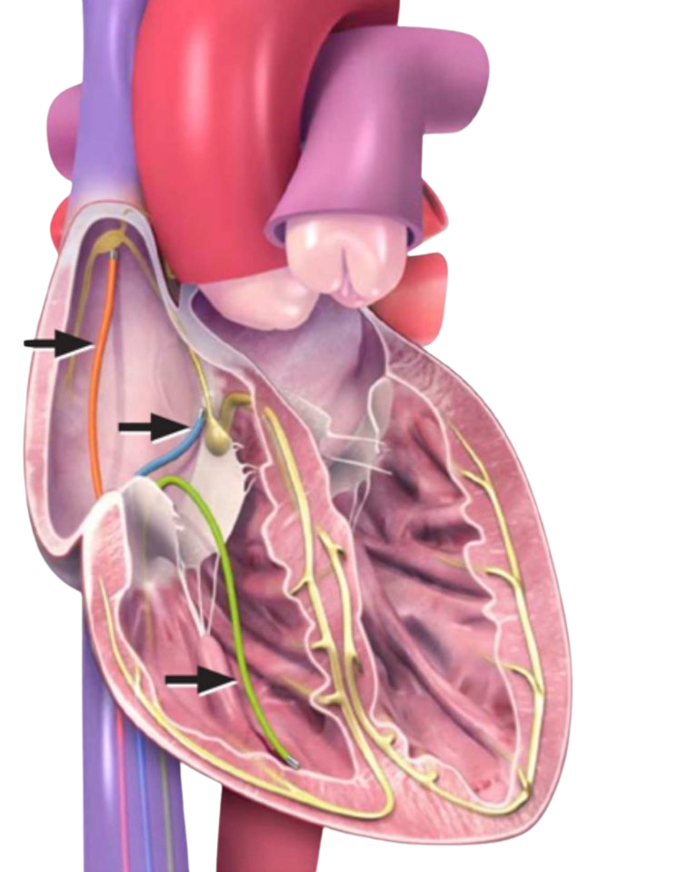 The EPS Procedure