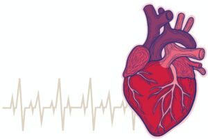 Arrhythmias