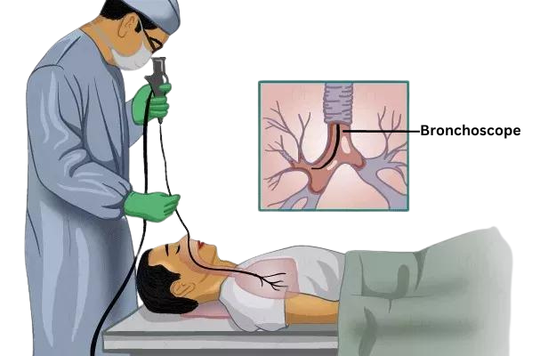 Bronchoscope