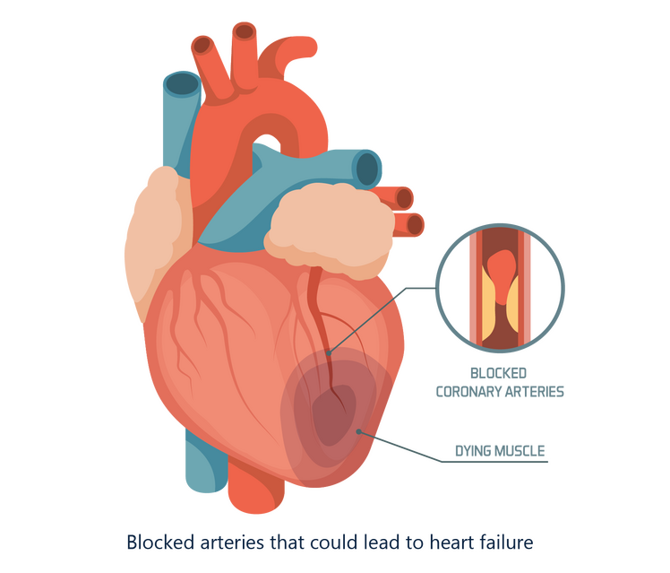 Heart Failure Clinic