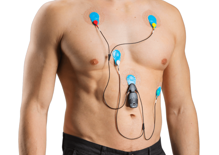 The Holter monitor