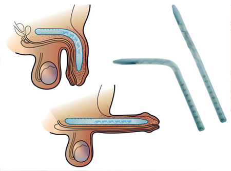 Andrology