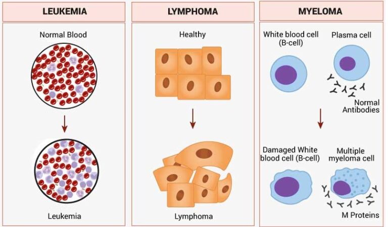 Blood-cancer-types