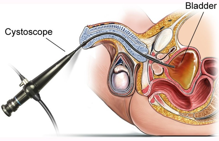 Endourology