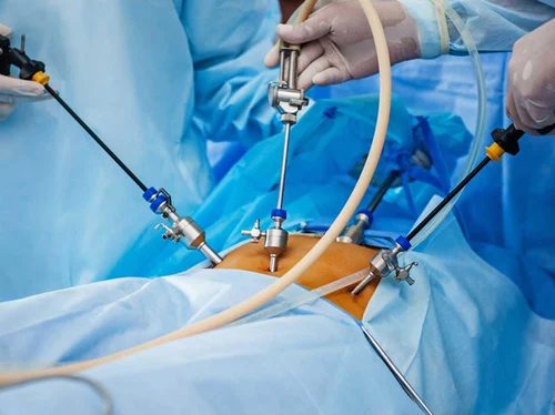 Laparoscopic Urology