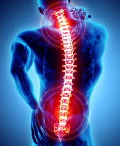 Spinal Surgery