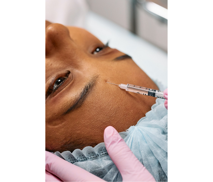 Botox (Botulinum Toxin)